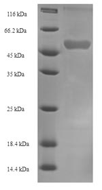 Recombinant Human NADPH:adrenodoxin oxidoreductase, mitochondrial (FDXR) – Figure 1 of 1