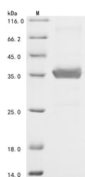 (Tris-Glycine gel) Discontinuous SDS-PAGE (reduced) with 5% enrichment gel and 15% separation gel.