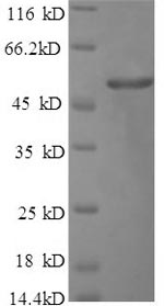 Recombinant Human FGA protein (FGA), partial – Figure 1 of 1