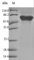 (Tris-Glycine gel) Discontinuous SDS-PAGE (reduced) with 5% enrichment gel and 15% separation gel.