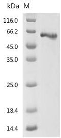 Recombinant Human Fibrinogen beta chain (FGB) – Figure 1 of 1