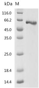 Recombinant Human Fibrinogen beta chain (FGB) – Figure 1 of 1