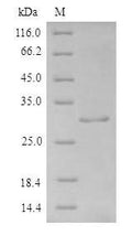 Recombinant Human Fibroblast growth factor 1 (FGF1) – Figure 1 of 1