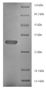 Recombinant Human Fibroblast growth factor 13 (FGF13) – Figure 1 of 1