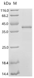 (Tris-Glycine gel) Discontinuous SDS-PAGE (reduced) with 5% enrichment gel and 15% separation gel.