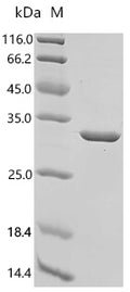 (Tris-Glycine gel) Discontinuous SDS-PAGE (reduced) with 5% enrichment gel and 15% separation gel.