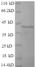 Recombinant Human Fibroblast growth factor receptor 3 (FGFR3), partial – Figure 1 of 1