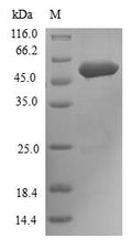 (Tris-Glycine gel) Discontinuous SDS-PAGE (reduced) with 5% enrichment gel and 15% separation gel.