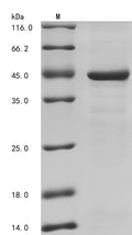 (Tris-Glycine gel) Discontinuous SDS-PAGE (reduced) with 5% enrichment gel and 15% separation gel.