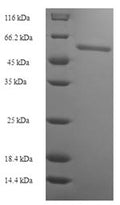Recombinant Human Acidic fibroblast growth factor intracellular-binding protein (FIBP) – Figure 1 of 1