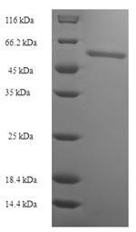 Recombinant Human Acidic fibroblast growth factor intracellular-binding protein (FIBP) – Figure 1 of 1