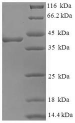 Recombinant Human Peptidyl-prolyl cis-trans isomerase FKBP3 (FKBP3) – Figure 1 of 1