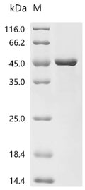 (Tris-Glycine gel) Discontinuous SDS-PAGE (reduced) with 5% enrichment gel and 15% separation gel.
