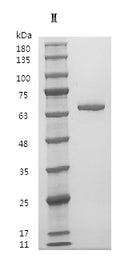 Recombinant Human Fibronectin (FN1), partial (Active) – Figure 1 of 1