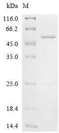 (Tris-Glycine gel) Discontinuous SDS-PAGE (reduced) with 5% enrichment gel and 15% separation gel.