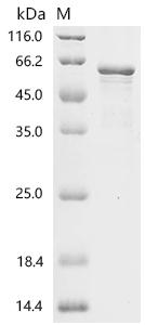 Recombinant Human Hepatocyte nuclear factor 3-alpha (FOXA1) – Figure 1 of 1