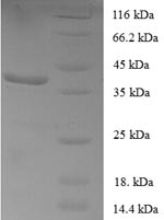 Recombinant Human Forkhead box protein P1 (FOXP1), partial – Figure 1 of 1