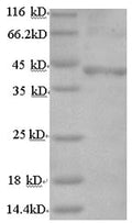 Recombinant Human Follicle-stimulating hormone receptor (FSHR), partial – Figure 1 of 1