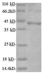 Recombinant Human Follicle-stimulating hormone receptor (FSHR), partial – Figure 1 of 1