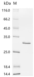 (Tris-Glycine gel) Discontinuous SDS-PAGE (reduced) with 5% enrichment gel and 15% separation gel.