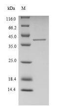 Recombinant Human Putative ribosomal RNA methyltransferase 1 (FTSJ1) – Figure 1 of 1