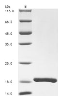 (Tris-Glycine gel) Discontinuous SDS-PAGE (reduced) with 5% enrichment gel and 15% separation gel.