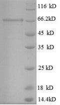 Recombinant Mouse Glutamate decarboxylase 2 (Gad2) – Figure 1 of 1
