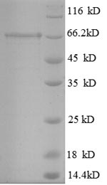 Recombinant Mouse Glutamate decarboxylase 2 (Gad2) – Figure 1 of 1