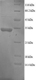 Recombinant Human Growth arrest and DNA damage-inducible protein GADD45 alpha (GADD45A) – Figure 1 of 1