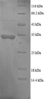 Recombinant Human Growth arrest and DNA damage-inducible protein GADD45 alpha (GADD45A) – Figure 1 of 1