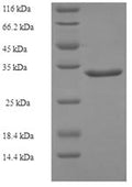 Recombinant Human Growth arrest and DNA damage-inducible protein GADD45 gamma (GADD45G) – Figure 1 of 1