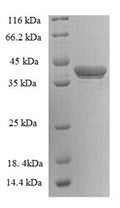 Recombinant Human G antigen 5 (GAGE5) – Figure 1 of 1