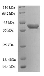 Recombinant Human G antigen 5 (GAGE5) – Figure 1 of 1