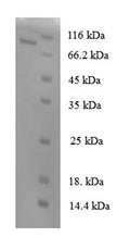 Recombinant Human N-acetylgalactosamine-6-sulfatase (GALNS) – Figure 1 of 1