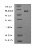 Recombinant Human Galactose-1-phosphate uridylyltransferase (GALT) – Figure 1 of 1