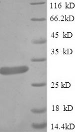 Recombinant Rat Guanidinoacetate N-methyltransferase (Gamt) – Figure 1 of 1