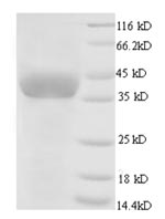 Recombinant Chicken Glyceraldehyde-3-phosphate dehydrogenase (GAPDH) – Figure 1 of 1