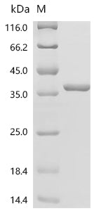 (Tris-Glycine gel) Discontinuous SDS-PAGE (reduced) with 5% enrichment gel and 15% separation gel.