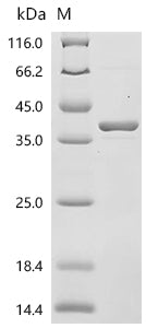 (Tris-Glycine gel) Discontinuous SDS-PAGE (reduced) with 5% enrichment gel and 15% separation gel.