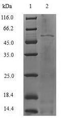 (Tris-Glycine gel) Discontinuous SDS-PAGE (reduced) with 5% enrichment gel and 15% separation gel.