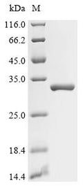 (Tris-Glycine gel) Discontinuous SDS-PAGE (reduced) with 5% enrichment gel and 15% separation gel.