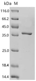 Recombinant Human Glutamate--cysteine ligase regulatory subunit (GCLM) – Figure 1 of 1