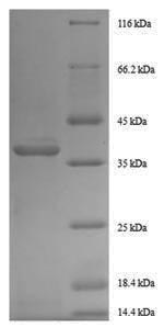 Recombinant Human Growth/differentiation factor 11 (GDF11) – Figure 1 of 1