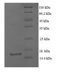 Recombinant Mouse Growth/differentiation factor 5 (Gdf5) – Figure 1 of 1