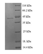 Recombinant Human Growth/differentiation factor 9 (GDF9) – Figure 1 of 1