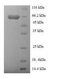 Recombinant Human Rab GDP dissociation inhibitor beta (GDI2) – Figure 1 of 1
