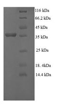 Recombinant Human Gamma-glutamylcyclotransferase (GGCT) – Figure 1 of 1