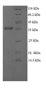 Recombinant Human Gamma-glutamylcyclotransferase (GGCT) – Figure 1 of 1