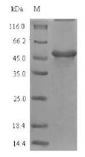 (Tris-Glycine gel) Discontinuous SDS-PAGE (reduced) with 5% enrichment gel and 15% separation gel.