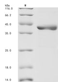 (Tris-Glycine gel) Discontinuous SDS-PAGE (reduced) with 5% enrichment gel and 15% separation gel.